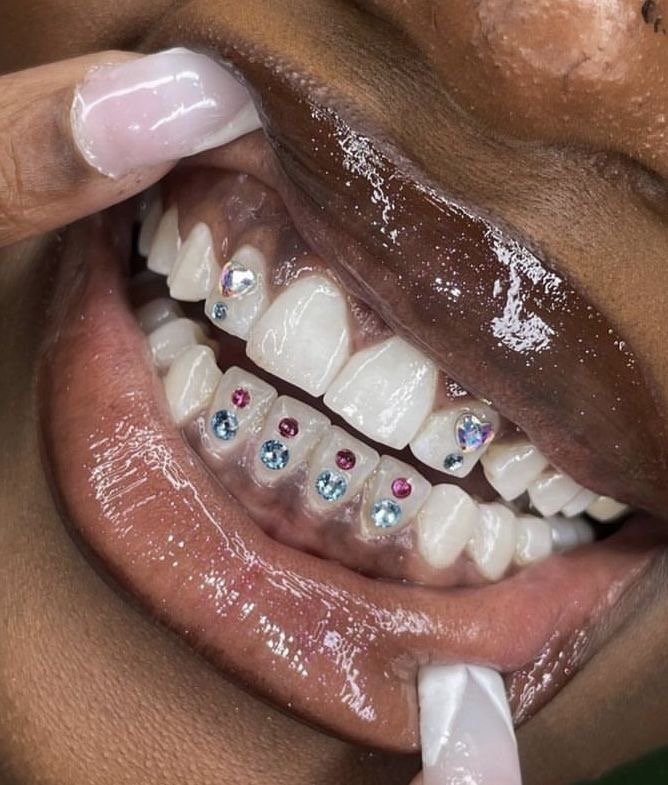 TOOTH GEMS